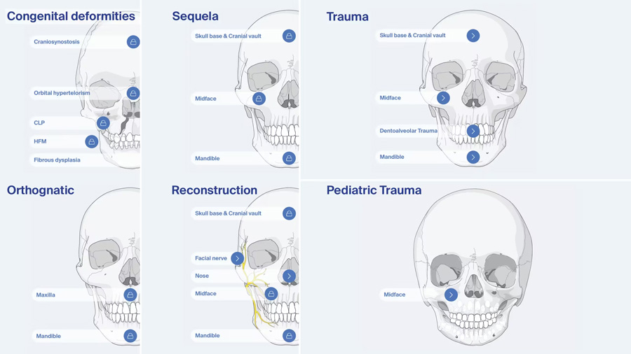 AO Surgery Reference CMF section