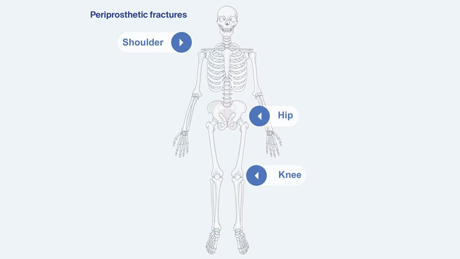 AO Surgery Reference Recon section