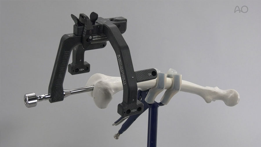 AO Foundation educational videos