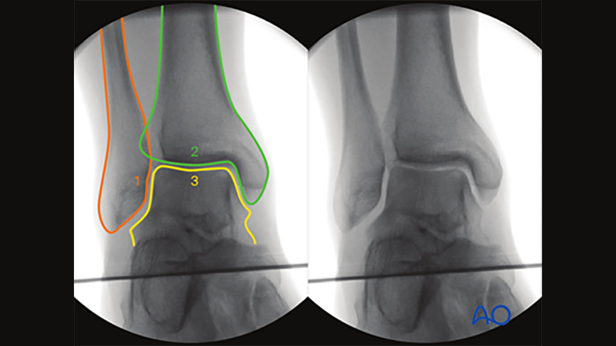 AO Surgery Reference Interoperative imaging