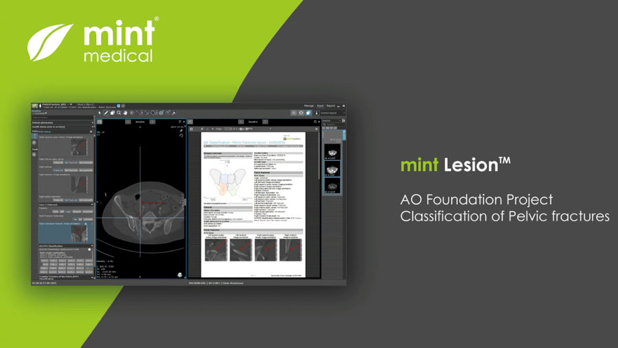 AI at AO Mint software