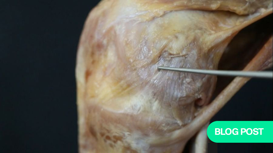 Anteromedial vs. posteromedial reconstructions