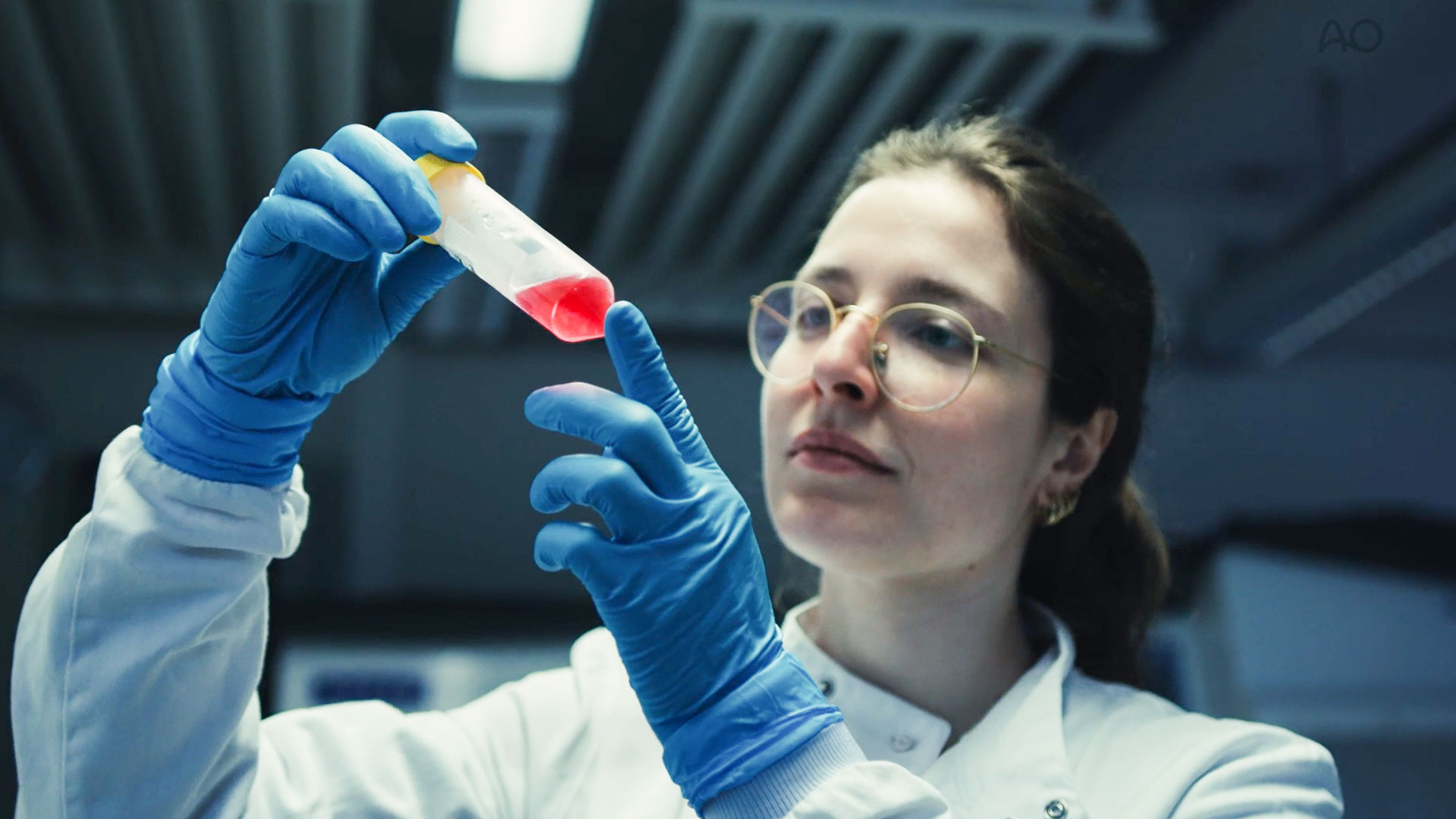 Why musculoskeletal research matters