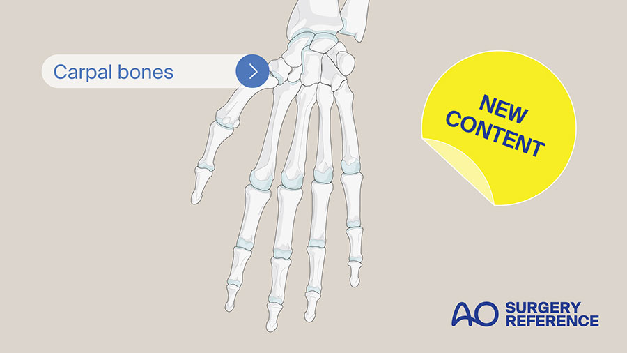 AO Surgery Reference update: Publication of Carpal bones