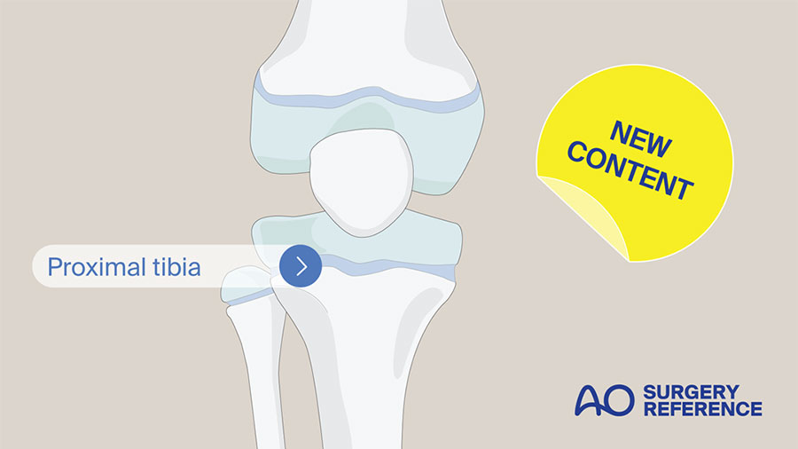 AO Surgery Reference update: New pediatric trauma content—Proximal tibia